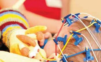 Ein Kinderkopf ist für eine Untersuchung mit Kabeln vernetzt